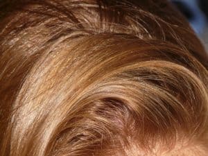 Top 7 Reasons Why Your Hair Is Greasy