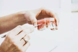  The Role of Dental Implants in Preserving Facial Structure